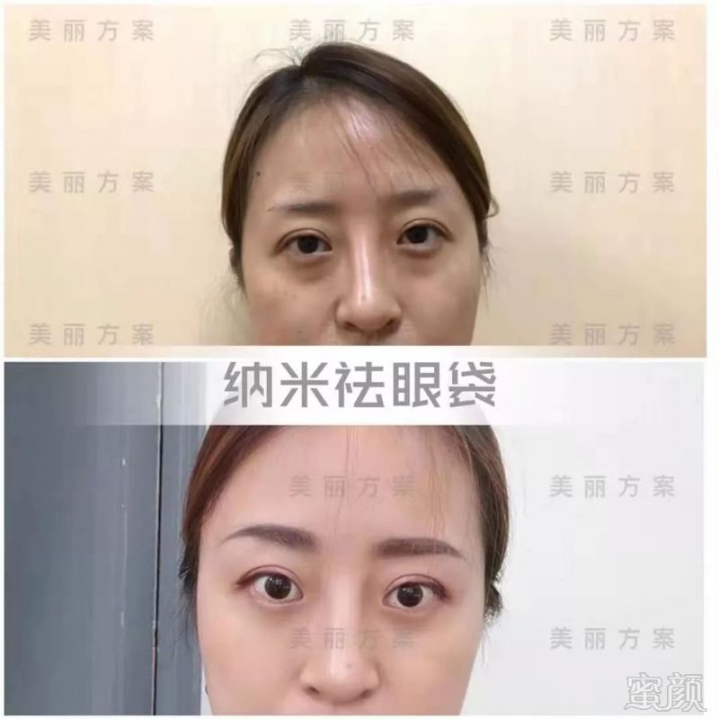 https://img.miyanlife.com/mnt/timg/191023/133J143D-10.jpg