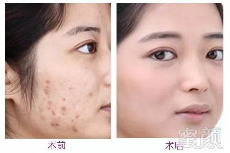 https://img.miyanlife.com/mnt/timg/191023/133T11229-7.jpg