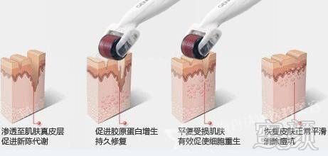 https://img.miyanlife.com/mnt/timg/191023/133T23D4-8.jpg