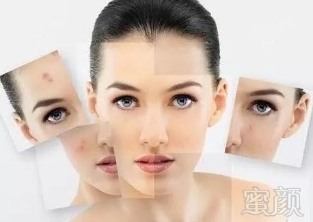 https://img.miyanlife.com/mnt/timg/191023/133T36210-11.jpg