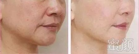 https://img.miyanlife.com/mnt/timg/191023/133T41X0-12.jpg