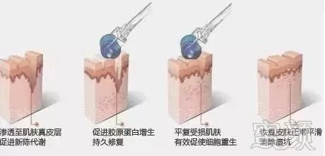 https://img.miyanlife.com/mnt/timg/191023/1H4522623-4.jpg