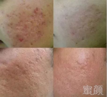 https://img.miyanlife.com/mnt/timg/191023/1H45244a-3.jpg