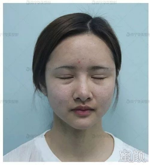 https://img.miyanlife.com/mnt/timg/191023/1H91UQ5-1.jpg