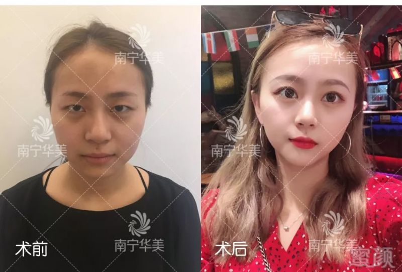 https://img.miyanlife.com/mnt/timg/191023/1H9204546-5.jpg