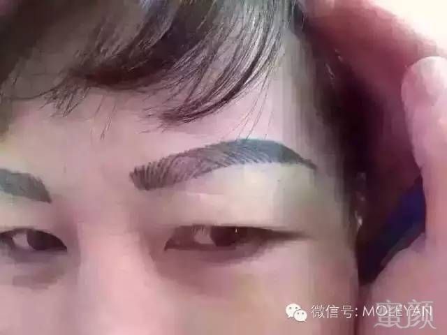 案例图片