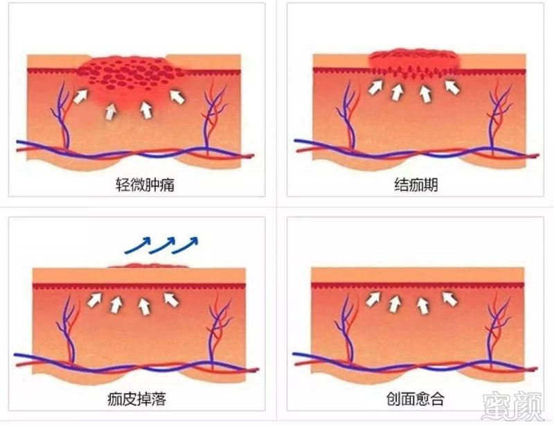 案例图片