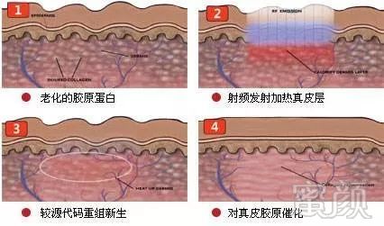 案例图片