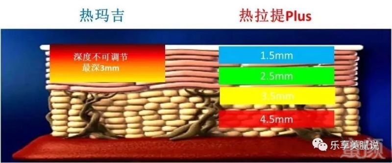 https://img.miyanlife.com/mnt/timg/191024/122950M48-2.jpg