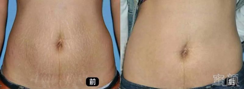 https://img.miyanlife.com/mnt/timg/191024/1233034116-10.jpg