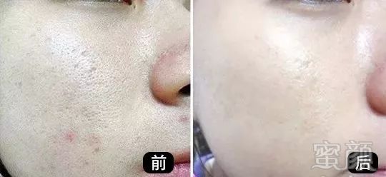 https://img.miyanlife.com/mnt/timg/191024/1233043331-12.jpg