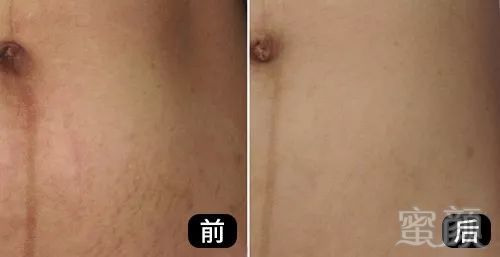 https://img.miyanlife.com/mnt/timg/191024/1233043934-11.jpg