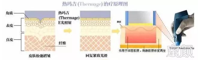 https://img.miyanlife.com/mnt/timg/191024/1235101H2-2.jpg