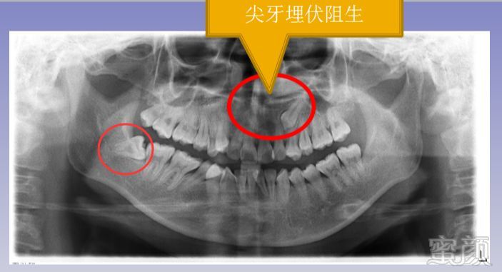 案例图片