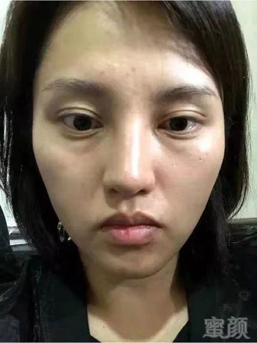 https://img.miyanlife.com/mnt/timg/191024/14015311N-1.jpg