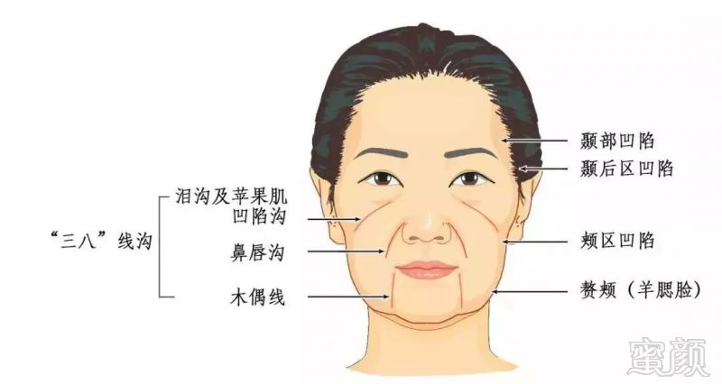 https://img.miyanlife.com/mnt/timg/191024/14023I925-7.jpg