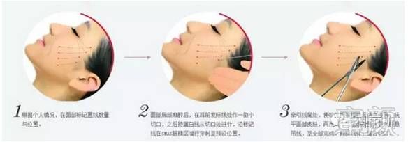 https://img.miyanlife.com/mnt/timg/191024/141Q633J-0.jpg