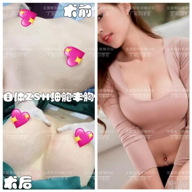 https://img.miyanlife.com/mnt/timg/191024/1420491160-5.jpg