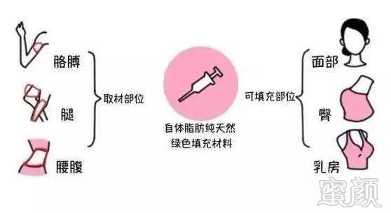 https://img.miyanlife.com/mnt/timg/191024/14204U363-1.jpg