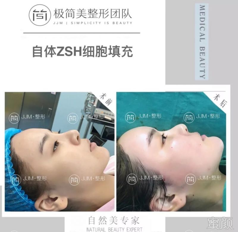 https://img.miyanlife.com/mnt/timg/191024/1420534301-8.jpg