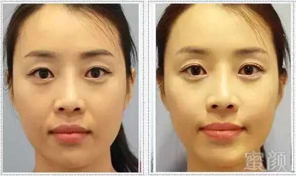 https://img.miyanlife.com/mnt/timg/191024/142GQS2-4.jpg
