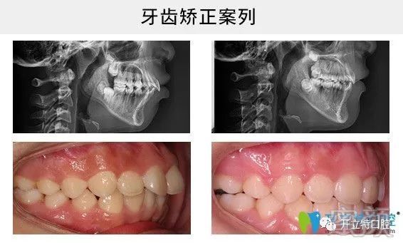 案例图片