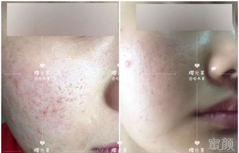 https://img.miyanlife.com/mnt/timg/191025/1243342233-7.jpg