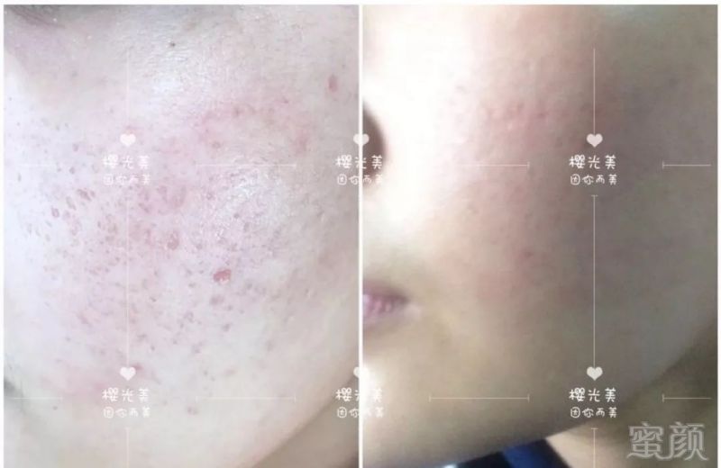 https://img.miyanlife.com/mnt/timg/191025/124334H34-6.jpg