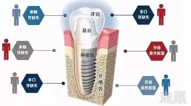 案例图片