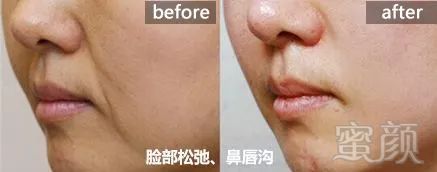 https://img.miyanlife.com/mnt/timg/191025/1246435621-14.jpg