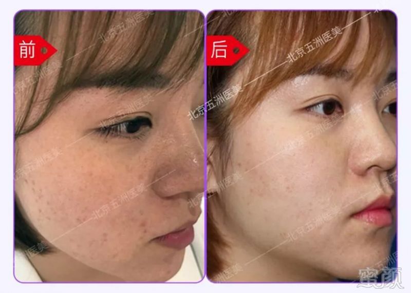 https://img.miyanlife.com/mnt/timg/191025/124T230G-8.jpg