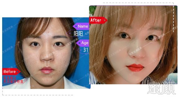 https://img.miyanlife.com/mnt/timg/191025/124T25457-7.jpg