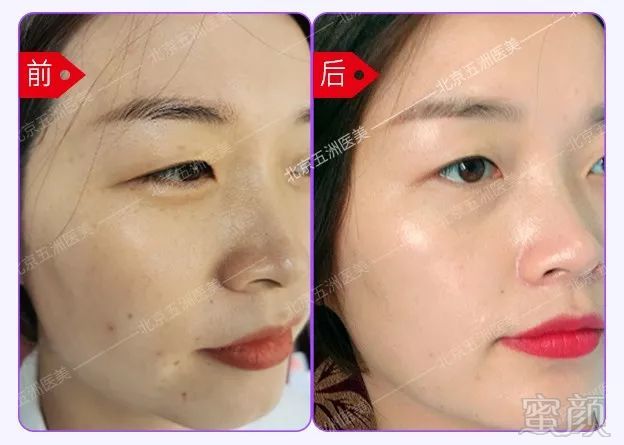 https://img.miyanlife.com/mnt/timg/191025/124T42V9-12.jpg