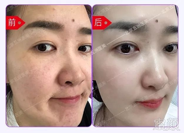 https://img.miyanlife.com/mnt/timg/191025/124T463I-10.jpg