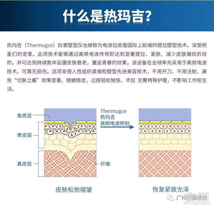 https://img.miyanlife.com/mnt/timg/191025/125633D17-1.jpg