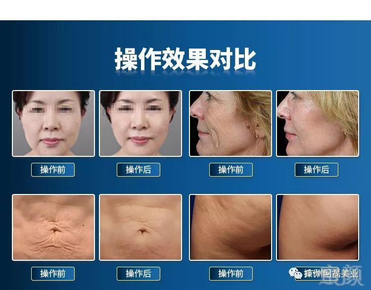 https://img.miyanlife.com/mnt/timg/191025/1256411R0-5.jpg