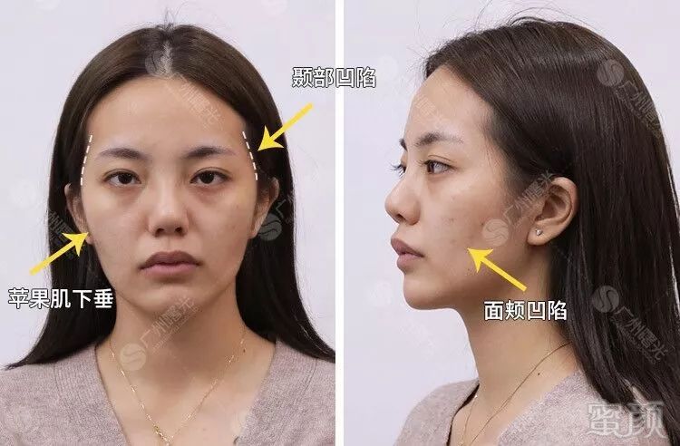 https://img.miyanlife.com/mnt/timg/191026/13394RP5-2.jpg