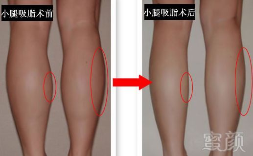 https://img.miyanlife.com/mnt/timg/191026/13462061P-7.jpg