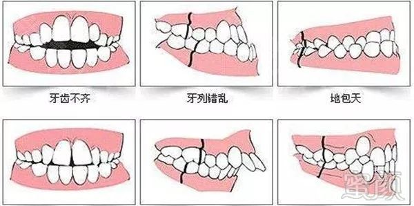 案例图片