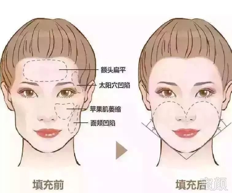 https://img.miyanlife.com/mnt/timg/191027/12102232U-3.jpg