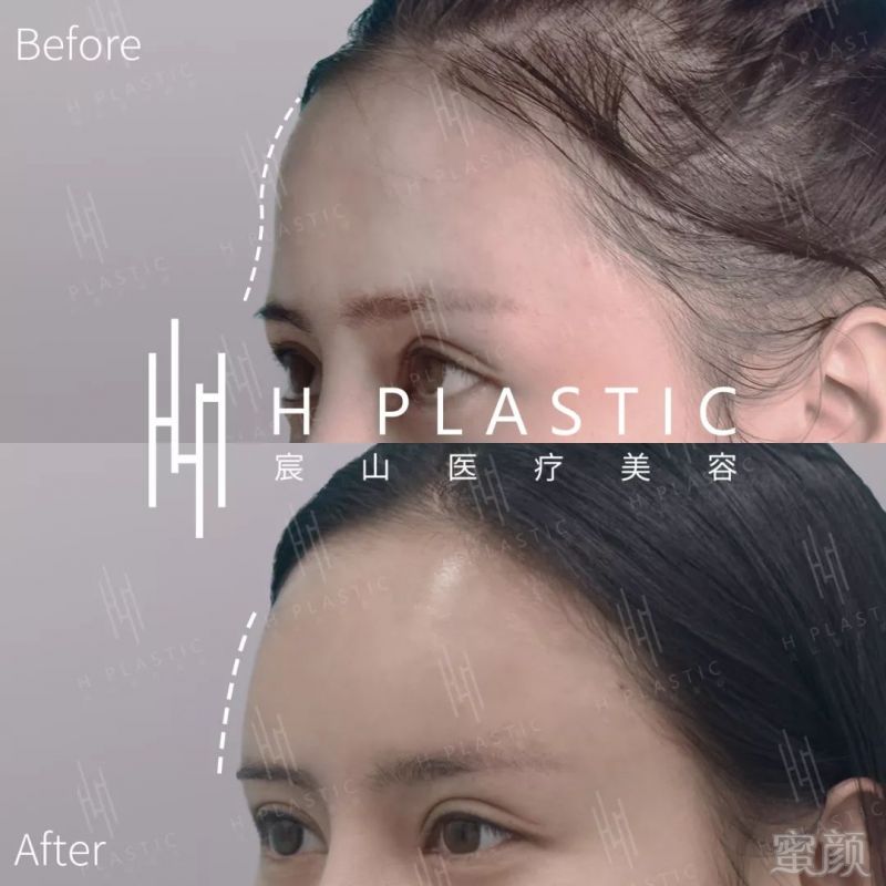https://img.miyanlife.com/mnt/timg/191027/1210243362-6.jpg