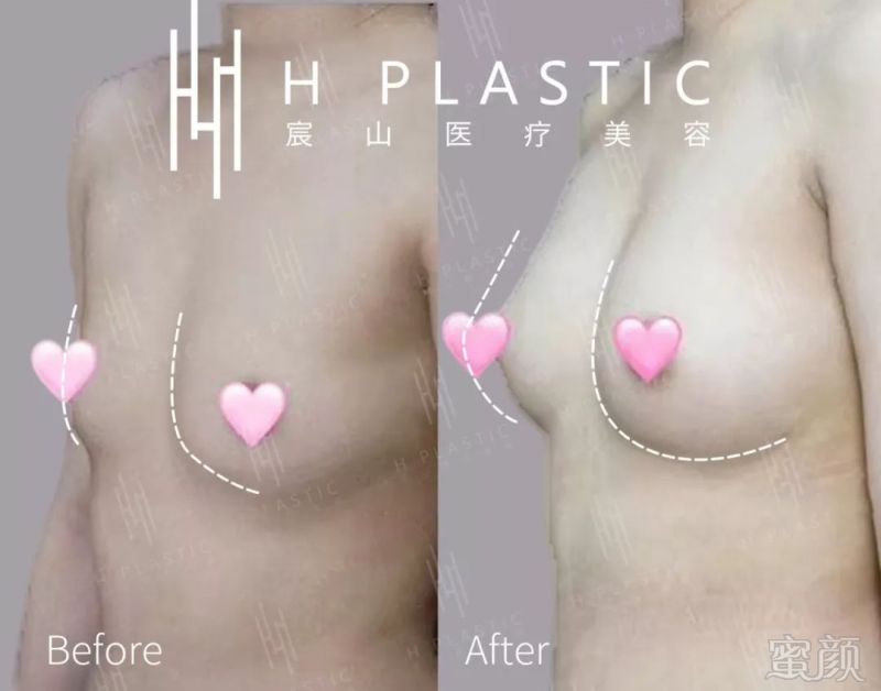https://img.miyanlife.com/mnt/timg/191027/1210252018-7.jpg