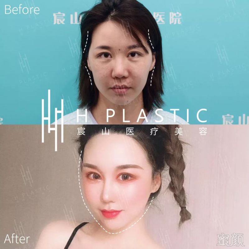 https://img.miyanlife.com/mnt/timg/191027/12102K564-9.jpg
