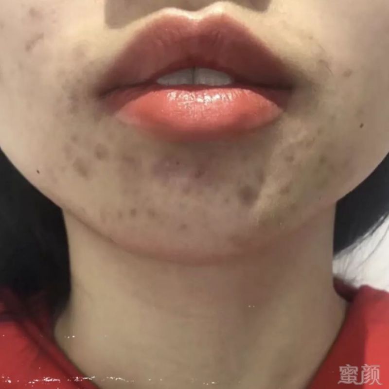 https://img.miyanlife.com/mnt/timg/191027/1214312J3-7.jpg