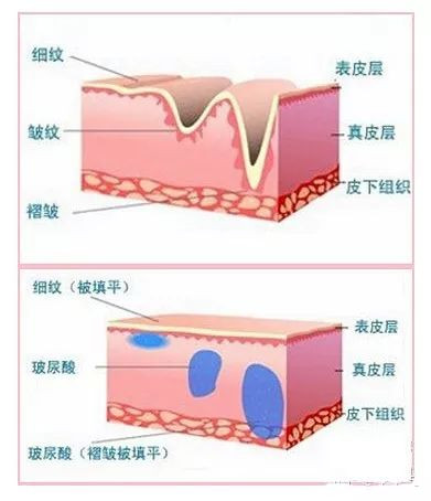 案例图片