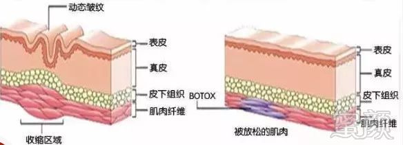 案例图片