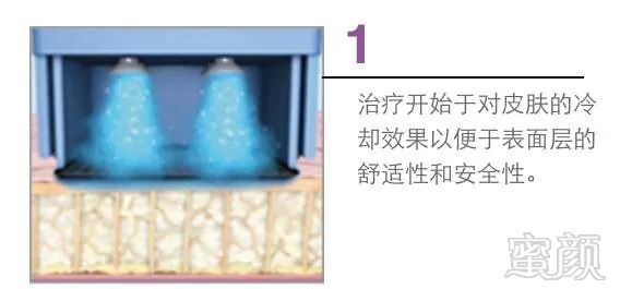 https://img.miyanlife.com/mnt/timg/191029/1213035Q1-2.jpg