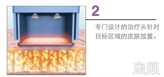 https://img.miyanlife.com/mnt/timg/191029/1213041596-3.jpg