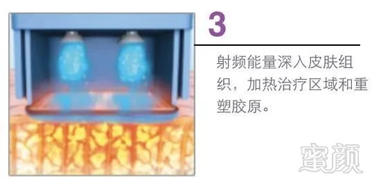 https://img.miyanlife.com/mnt/timg/191029/1213046228-4.jpg