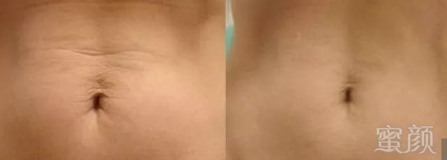https://img.miyanlife.com/mnt/timg/191029/1213062N6-8.jpg